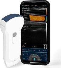 Zdjęcie Usg Dwu Głowicowy Aparat 3W1 + Kolor Doppler Wifi Usb - Kalety