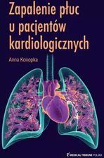 Zdjęcie Zapalenie płuc u pacjentów kardiologicznych - Kamień Krajeński
