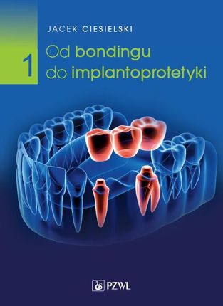 Od bondingu do implantoprotetyki Część 1 (EPUB)