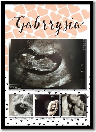 Plakat ze zdjęciami usg 3 trymestry ciąży pamiątka