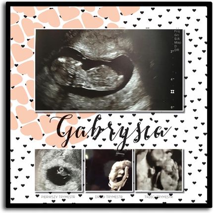 Pamiątka z ciąży, zdjęcia USG, trymesty ciąży