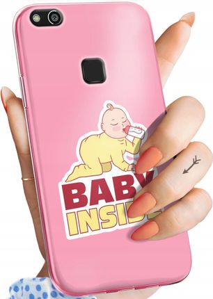 Hello Case Etui Do Huawei P10 Lite Ciążowe Pregnant