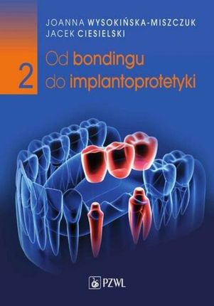 Od bondingu do implantoprotetyki Część 2 (MOBI)