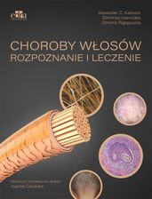 Zdjęcie Choroby włosów. Rozpoznanie i leczenie - Oleśnica