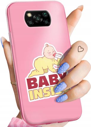 Hello Case Etui Do Xiaomi Poco X3 Nfc Ciążowe Pregnant Baby Shower Obudowa