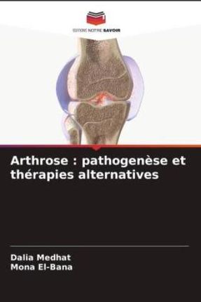 Arthrose : pathogen?se et thérapies alternatives