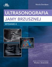 Zdjęcie Ultrasonografia jamy brzusznej - Nowogród Bobrzański