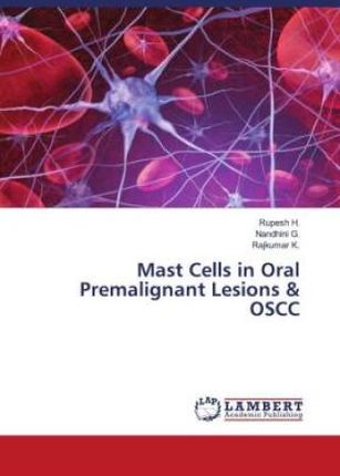 Mast Cells in Oral Premalignant Lesions & OSCC