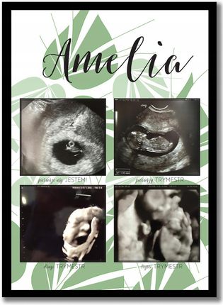 Trymestry ciąży, zdjęcia USG, pamiątka z ciąży prezent na Baby Shower Ciąża