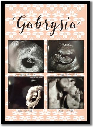 Plakat ze djęciami z USG, pamiątka z ciąży prezent na Baby Shower Ciąża