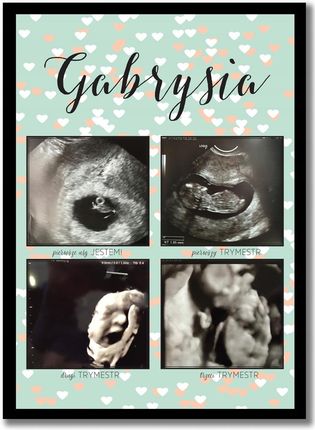 Plakat ze zdjęciami z USG, pamiątka z ciąży prezent na Baby Shower Ciąża