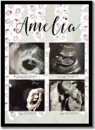 Plakat, pamiątka z ciąży ze zdjęciami z usg