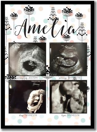 3 Trymestry ciąży, zdjęcia z USG, pamiątka z ciąży plakat