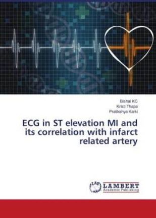 ECG in ST elevation MI and its correlation with infarct related artery