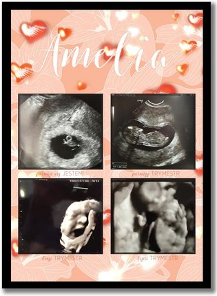 Plakat z trymestrami ciąży, zdjęcia USG, pamiątka z ciąży prezent