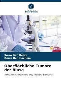 Oberflächliche Tumore der Blase - BEN REJEB SARRA