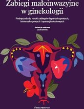 Zdjęcie Zabiegi małoinwazyjne w ginekologii - Władysławowo