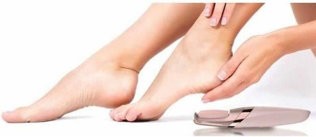 フットケア Electric Callus Remover Amazon.co.jp: Electric Callus Remover, Ravifun Foot File