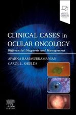 Zdjęcie Clinical Cases in Ocular Oncology: Clinical Cases in Ocular Oncology - Kock