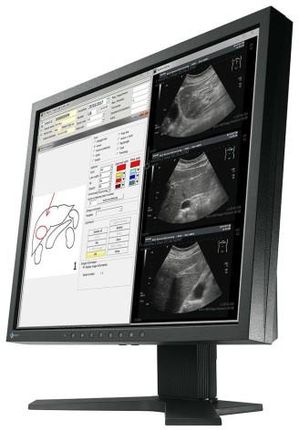 Eizo Monitor Medyczny Radiforce Mx194 (C809784Ab) - Ceny i