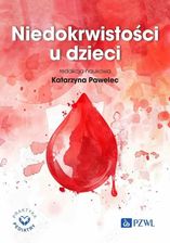 Zdjęcie Niedokrwistości u dzieci - Przemyśl