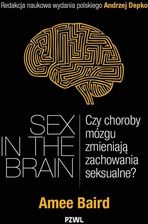 Zdjęcie Sex in the Brain. Czy choroby mózgu zmieniają zachowania seksualne?  - Dąbrowa Tarnowska