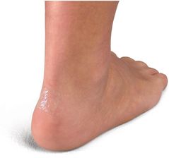 Zdjęcie Mueller Podkładki Hydrożelowe Cienkie Przylegające Na Odciski Otarcia Białe - Baranów Sandomierski