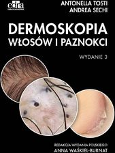 Zdjęcie Dermoskopia włosów i paznokci - Głuszyca