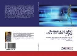 Diagnosing the Culprit artery in inferior wall M.I. on ECG