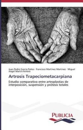 Artrosis Trapeciometacarpiana