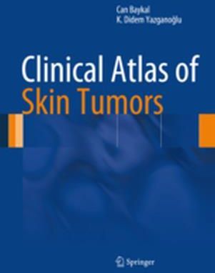 Clinical Atlas Of Skin Tumors