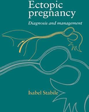 Ectopic Pregnancy Diagnosis and Management