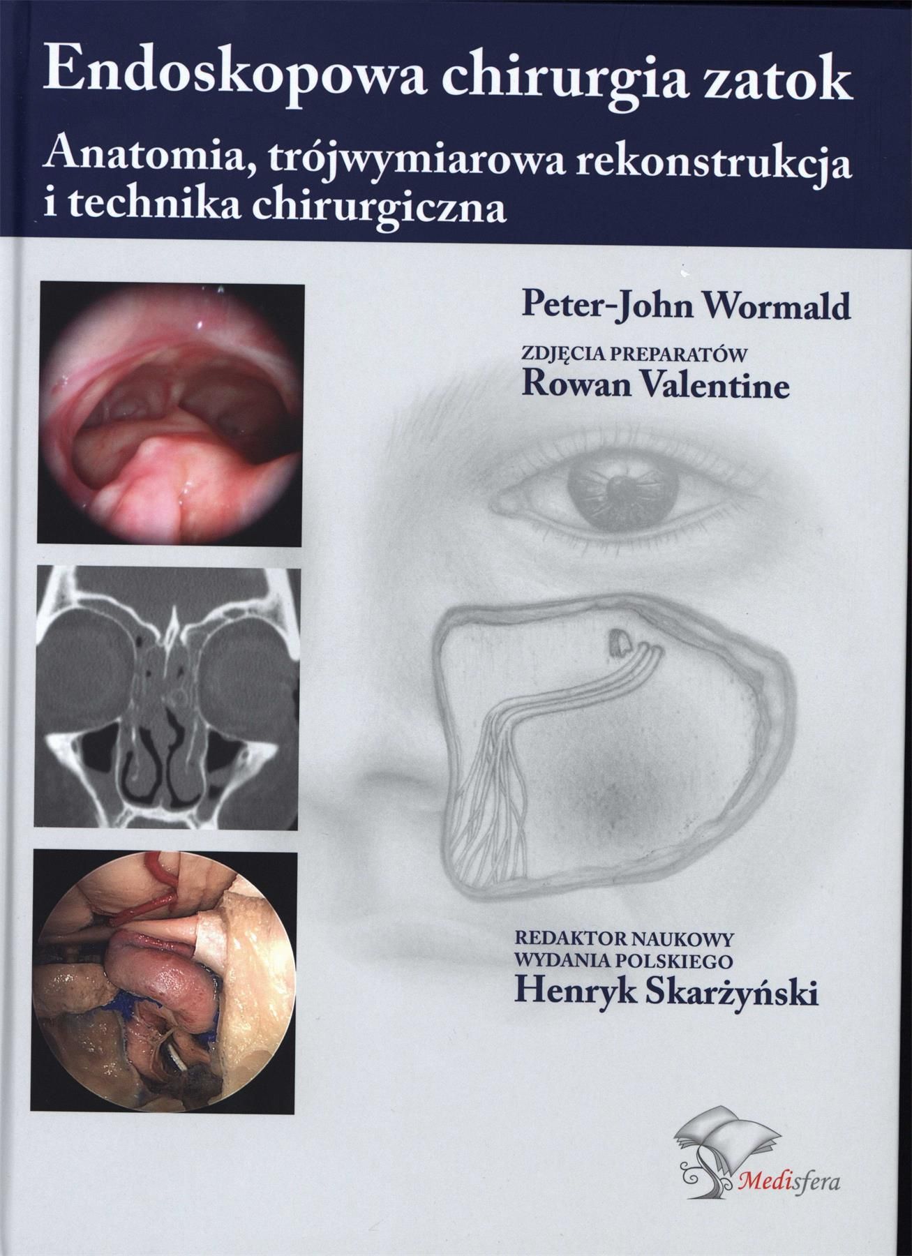 Książka Endoskopowa chirurgia zatok Ceny i opinie Ceneo.pl