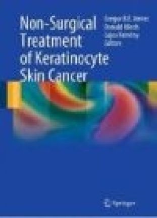Non Surgical Treatment of Keratinocyte Skin Cancer