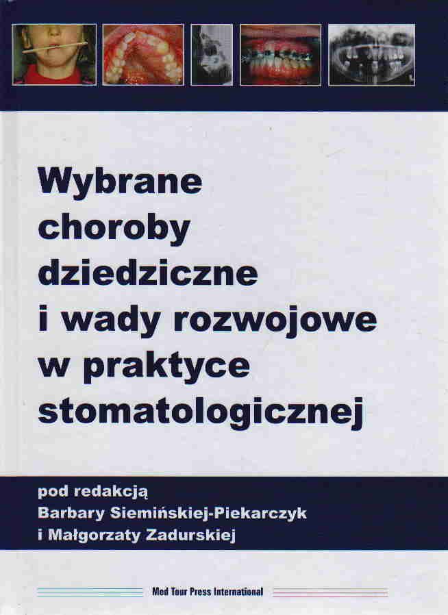 Podręcznik Medyczny Wybrane Choroby Dziedziczne I Wady Rozwojowe W ...