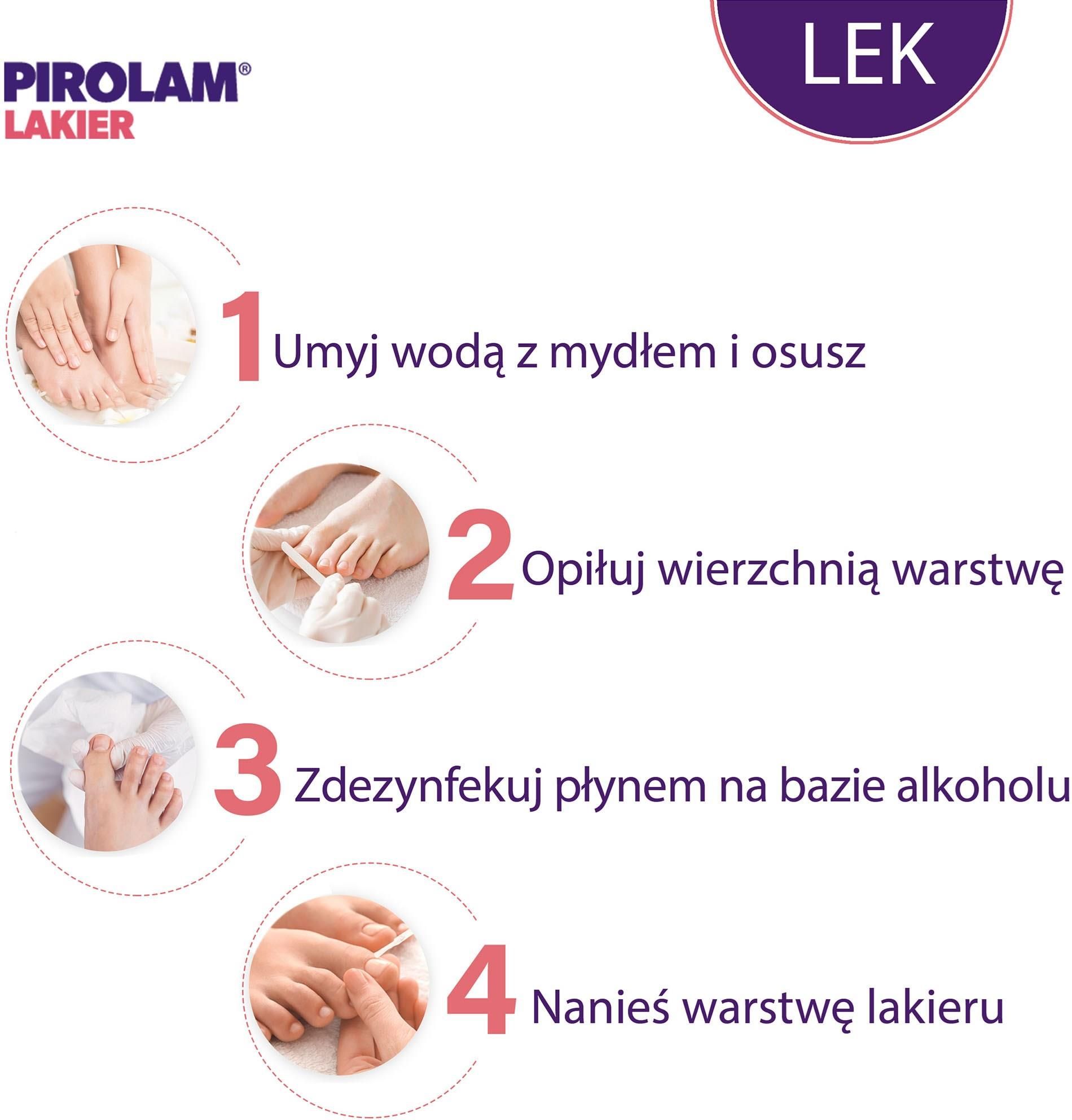 Pirolam lakier do paznokci 80mg/g 4g - zdjęcie 3 Pirolam lakier do paznokci 80mg/g 4g