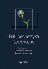 Zdjęcie Rak pęcherzyka żółciowego - Legionowo