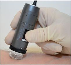 Dino-Lite Dermatoskop Medl4Dw (Videodermatoskop)