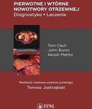 Zdjęcie Pierwotne i wtórne nowotwory otrzewnej - Twardogóra