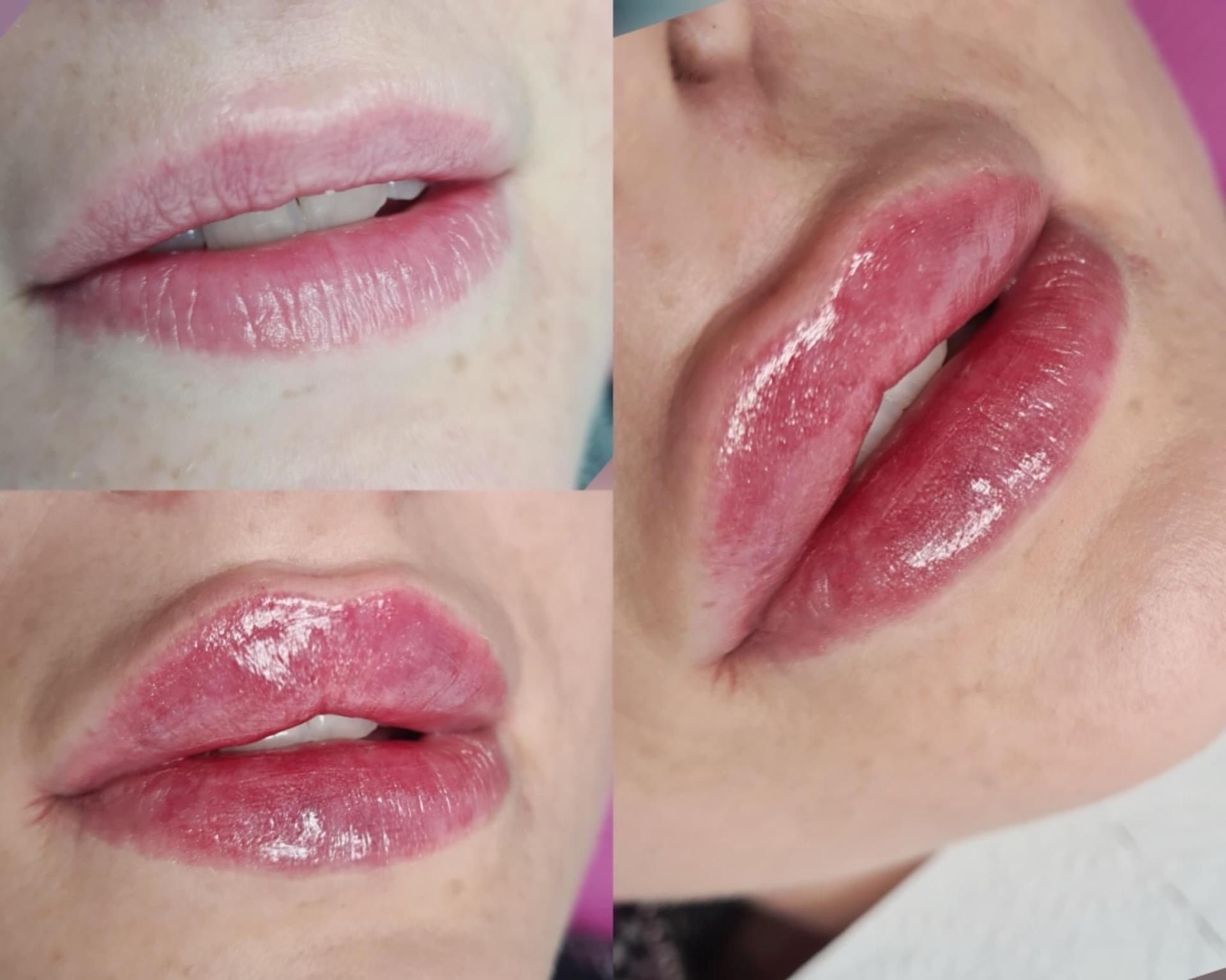 Princess Filler 1Ml Ceny i opinie Ceneo.pl