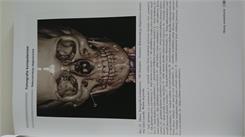 Anatomia radiologiczna rtg tk mr usg