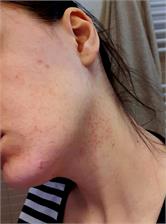 Krem Bielenda Professional SupremeLab Sebio Derm z Bakuchiolem na dzień i noc 50ml