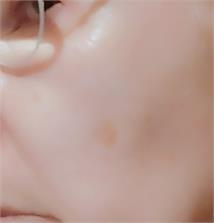 Nivea Cellular Luminous 630 Intensywne Serum Do Twarzy Przeciw Przebarwieniom 30 ml