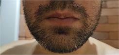PHILIPS OneBlade Pro 360 Face + Body QP6551/15