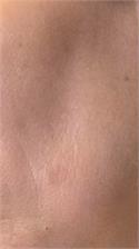 Sesderma S.L. Sesderma Azelac Ru Zestaw: Krem Żel Do Twarzy 50 Ml + Serum 30 Ml